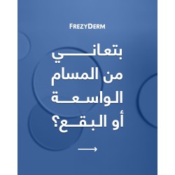 سيروم فريزي ديرم نياكيناميد 10% – توحيد لون البشرة وتنظيم الدهون | 30 مل