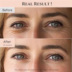 BEAUTY OF JOSEON REVIVE EYE SERUM RETINAL + NIACINAMIDE 30ML | DARK CIRCLE & WRINKLE CORRECTOR