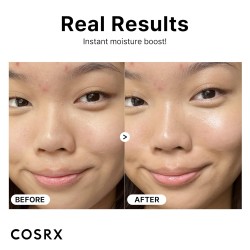 COSRX HYALURONIC ACID 3% SERUM 20ML | INTENSE HYDRATION FOR DRY & AGING SKIN