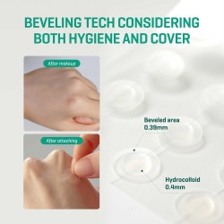 Some By Mi 30 Days Miracle Clear Spot Patch – Hydrocolloid Acne Patches 18 pcs