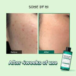 Some By Mi Truecica Micellar Cleansing Water – Soothing AHA BHA PHA Makeup Remover 300ml