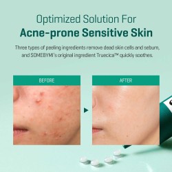 Some By Mi Super Miracle Spot All Kill Cream – AHA BHA PHA Acne Treatment 30ml