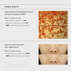 Some By Mi Yuja Niacin Anti Blemish Cream – 5% Niacinamide & Alpha-Bisabolol – 60ml