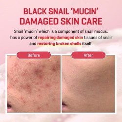 غسول الجل المعجزة Snail Truecica من Some By Mi – إصلاح وتهدئة للبشرة الحساسة – 100مل
