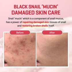 Some By Mi Snail Truecica Miracle Repair Serum – Post-Acne & Barrier Care – 50ml