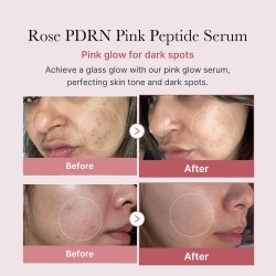 MEDICUBE PDRN Pink Peptide Serum – Glow Boosting & Firming Care – 30ml