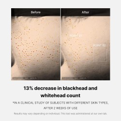سيروم ZERO PORE ليوم واحد من MEDICUBE – تقشير وشد المسام ليلي – 30مل