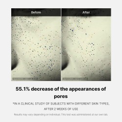 كريم ZERO PORE ليوم واحد من MEDICUBE – تقليل المسام وتنظيم الدهون – 50مل