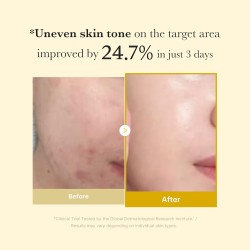 MEDICUBE Kojic Acid Turmeric Overnight Peel-Off Mask – Brightening & Glow – 75ml