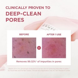 SKIN1004 Poremizing Deep Cleansing Foam – Clay-Based Pore Cleanser – 125ml