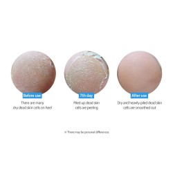 FRUDIA PEACH FOOT PEELING MASK – 1PAIR