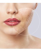البشرة الدهنية | La Jolie Beauty