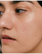 البشرة المختلطة | La Jolie Beauty